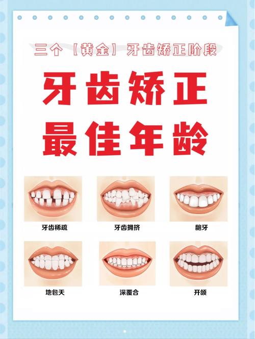 牙齿矫正的最佳时机-图1