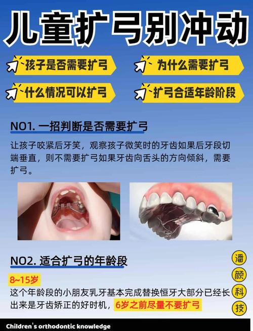 矫正牙齿扩弓的利弊-图1 矫正牙齿扩弓的利弊-图1