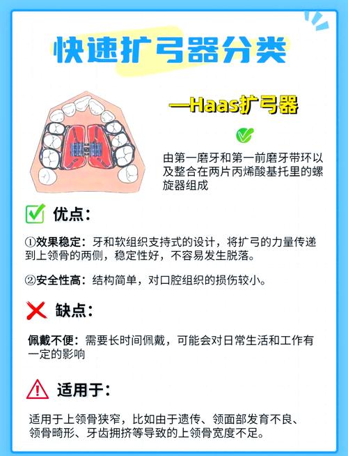 矫正牙齿扩弓的利弊-图3 矫正牙齿扩弓的利弊-图3