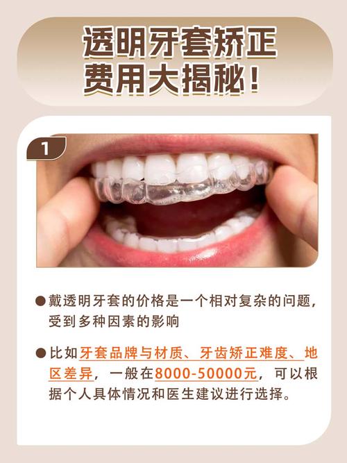 透明牙齿矫正器价格差异大，究竟为什么？-图2