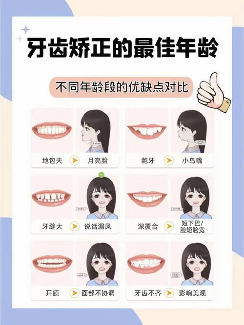 矫正牙齿的时间长短，究竟需要多久？影响因素有哪些？-图2