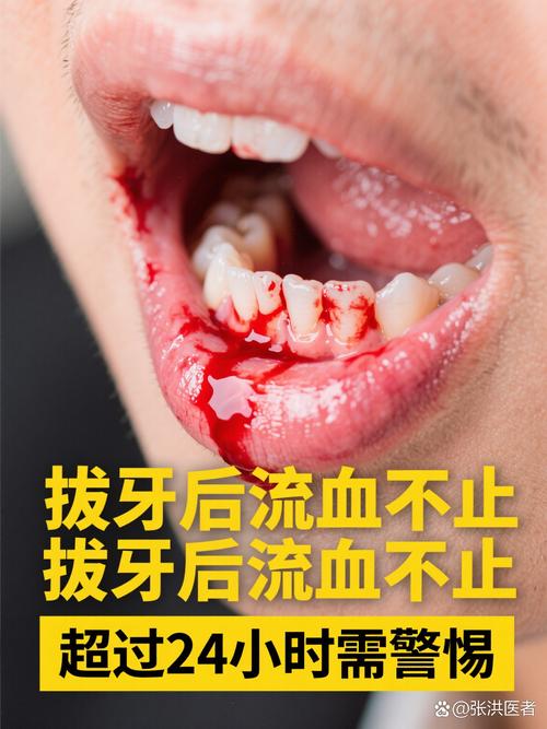 牙齿矫正后牙龈出血？原因何在？如何应对？-图1