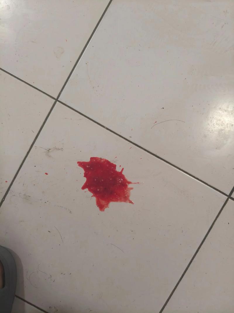 牙齿矫正后牙龈出血？原因何在？如何应对？-图3