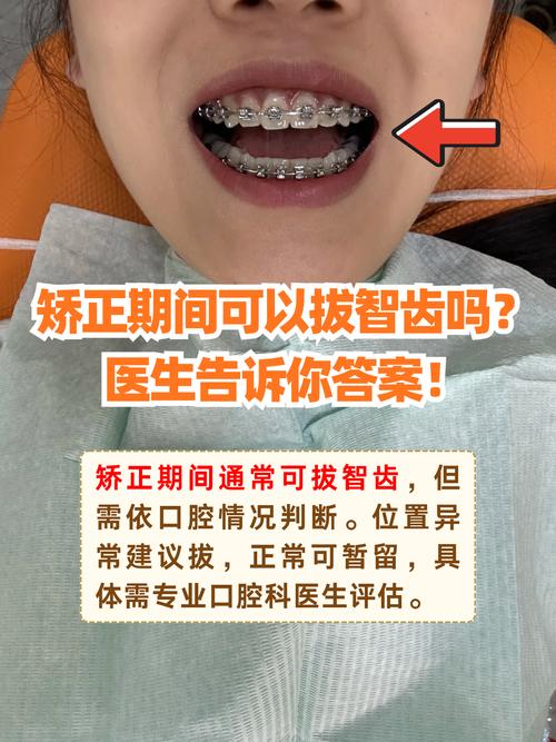 矫正期间拔智齿，真的有必要吗？-图2