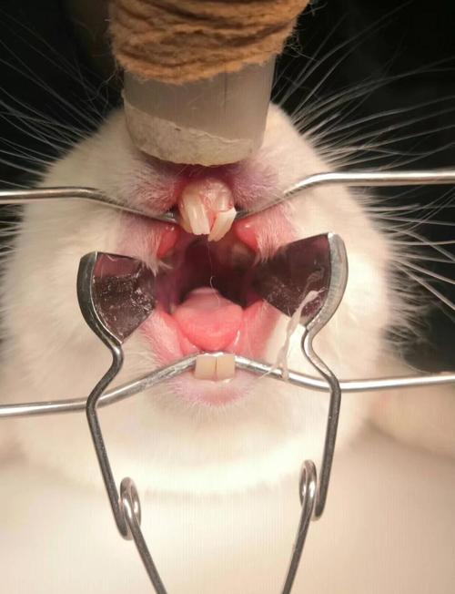 西安小白兔牙齿矫正靠谱吗?效果和价格怎么样?-图3 西安小白兔牙齿矫正靠谱吗?效果和价格怎么样?-图3