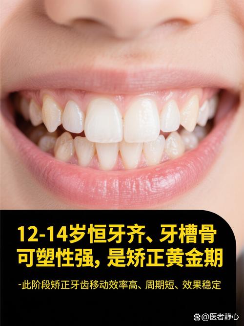 22岁矫正牙齿晚吗？现在矫正还来得及吗？-图2