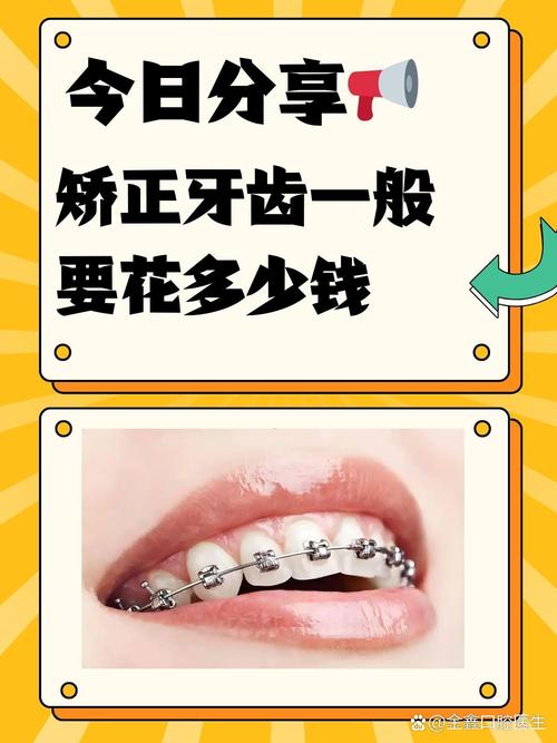 牙齿矫正要多久不疼-图1