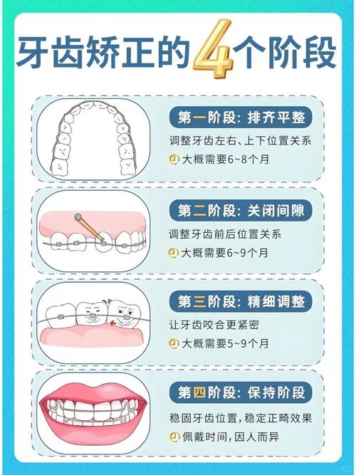 牙齿矫正收牙缝图解-图2 牙齿矫正收牙缝图解-图2