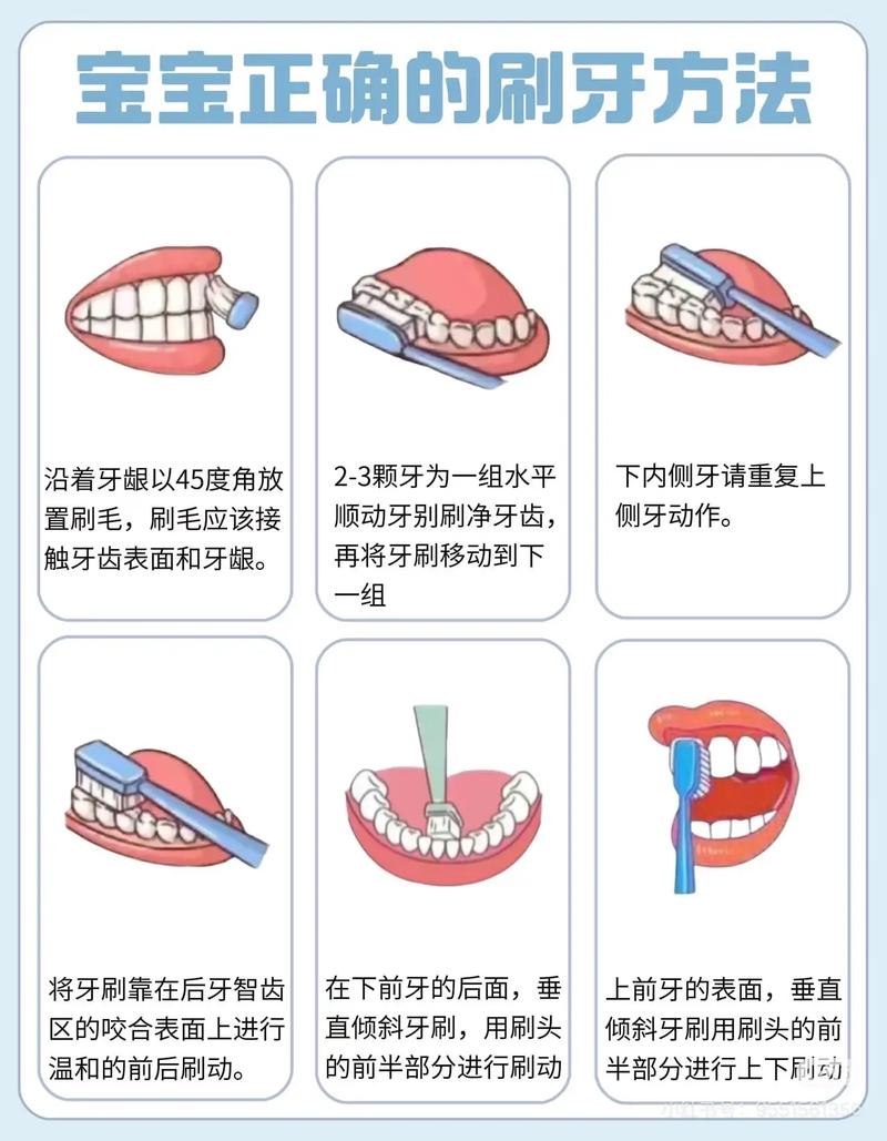 矫正牙齿后如何正确刷牙？方法详解-图2