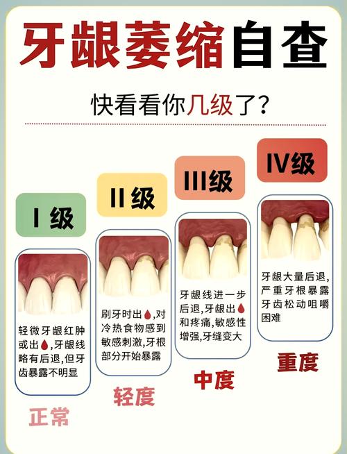 矫正牙齿牙龈萎缩图-图1