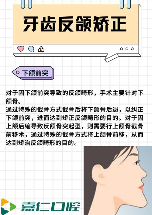 牙齿不齐需要矫正吗？这些情况该不该处理？-图3