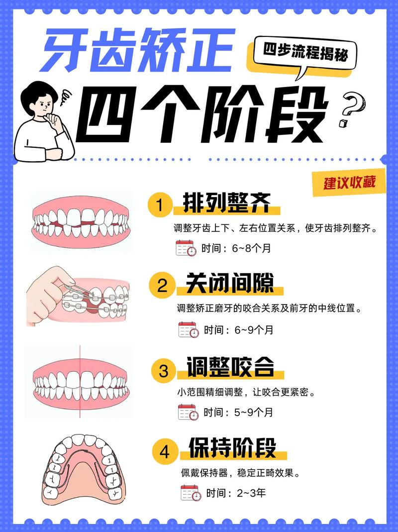 牙齿矫正有哪些阶段-图2 牙齿矫正有哪些阶段-图2