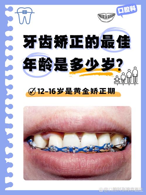 牙齿矫正几年不反弹-图2