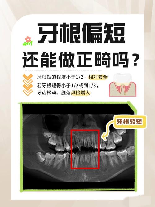 牙根短矫正可行吗？正畸风险大不大？安全方法有哪些？-图1