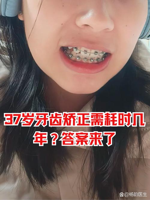 漳州牙齿矫正哪里好-图3