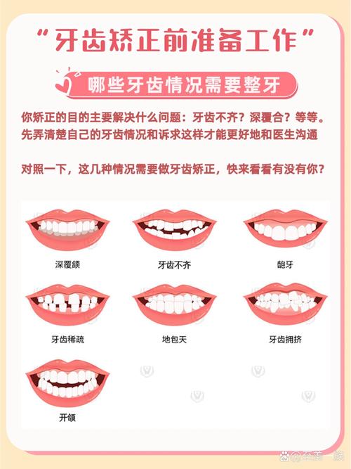 快速矫正牙齿有哪些高效方法？-图1