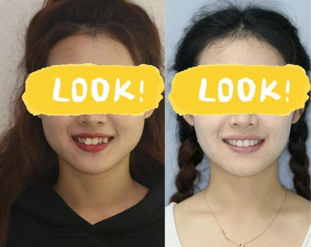 重庆牙齿矫正怎么选？效果、价格、服务，哪家靠谱？-图1