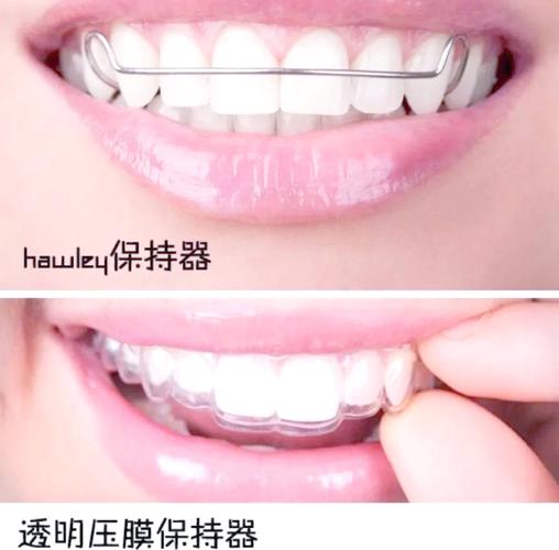 牙齿矫正维持器图片-图2