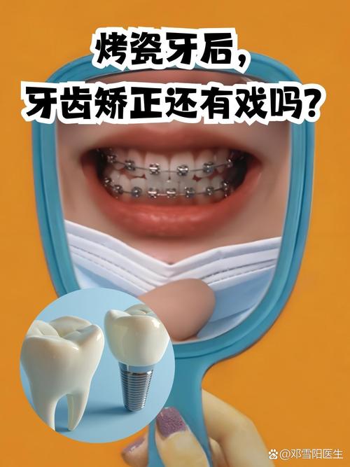 矫正牙齿去哪里做好？选机构要注意哪些关键点？-图3