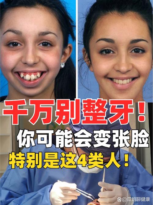 牙齿矫正后牙齿变长,是正常变化还是异常表现?该如何处理?-图1 牙齿矫正后牙齿变长,是正常变化还是异常表现?该如何处理?-图1