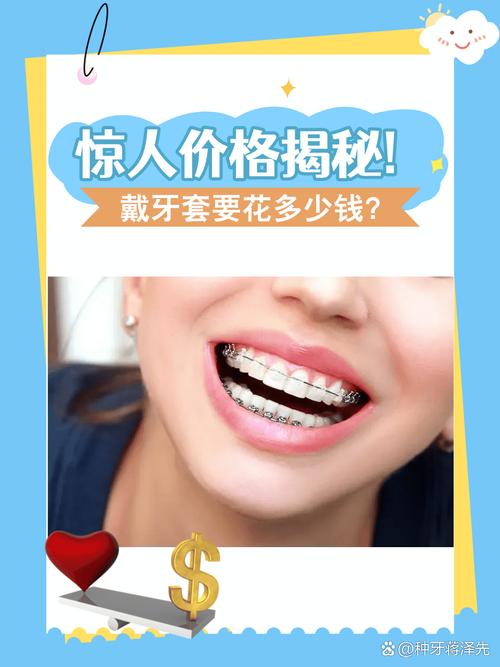 四川矫正牙齿多少钱？不同医院收费差异大吗？-图2