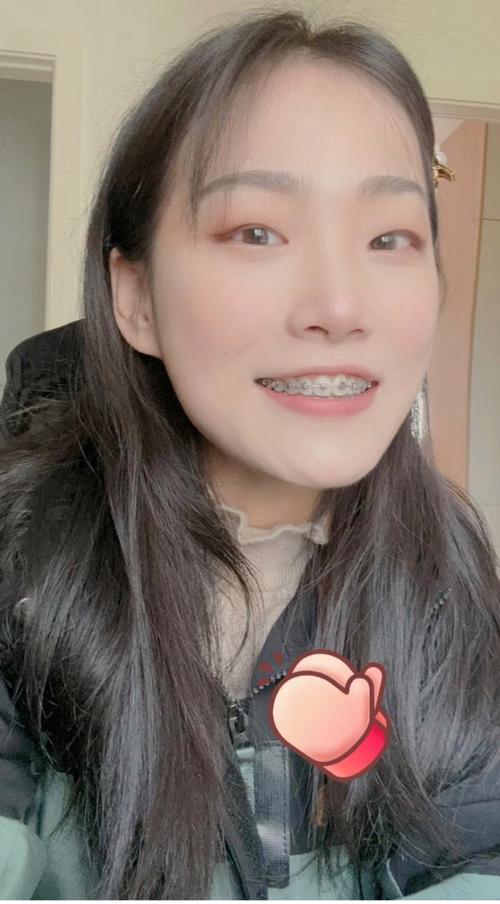 25岁后矫正牙齿，年龄大了还来得及吗？-图1