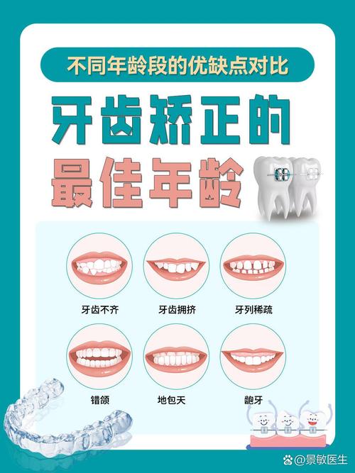 矫正牙齿要注意哪些-图1