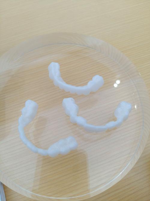 成人牙齿矫正后，是否必须做美容冠？-图3