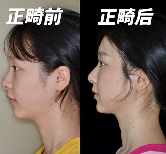 宁波矫正牙齿哪家好-图3