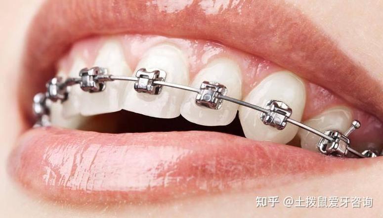 上海哪个牙齿矫正好-图3