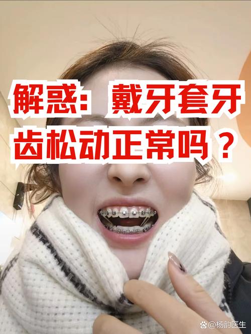 矫正牙齿松动是正常现象吗？-图1