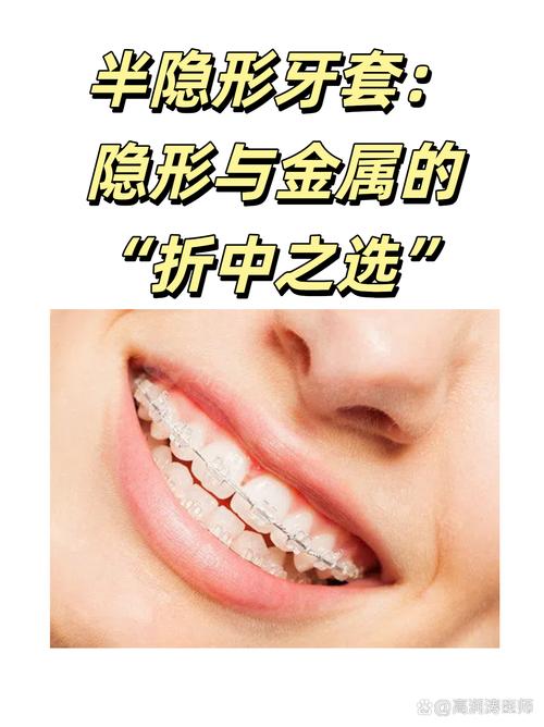 隐形矫正牙齿的弊端-图2
