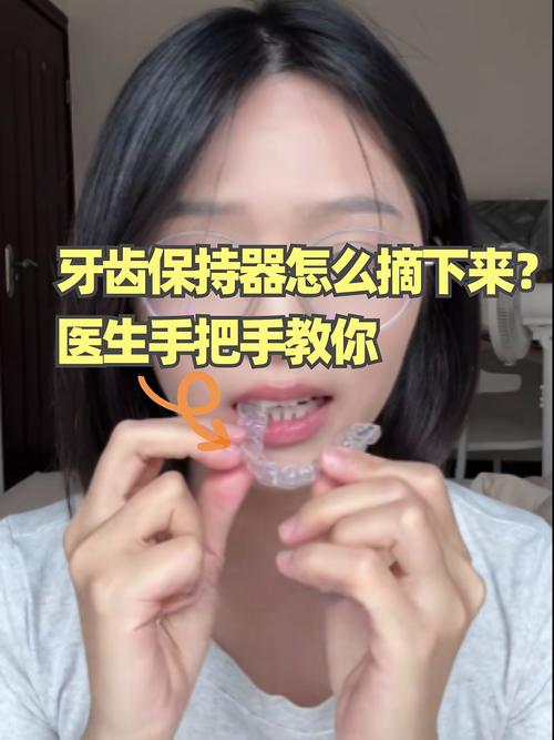 牙齿矫正器一般要戴多久？矫正时长受哪些因素影响？-图3