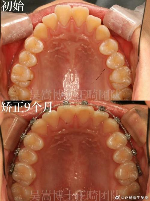 南京矫正牙齿哪家好?如何选专业靠谱的矫正机构?-图3 南京矫正牙齿哪家好?如何选专业靠谱的矫正机构?-图3