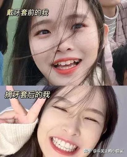 贵阳哪里矫正牙齿好-图2