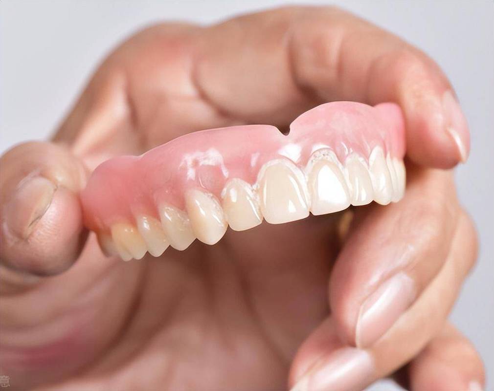 戴假牙的人能做牙齿矫正吗？-图3