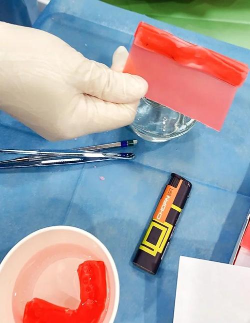 矫正牙齿后硬东西到底能不能吃?-图2 矫正牙齿后硬东西到底能不能吃?-图2