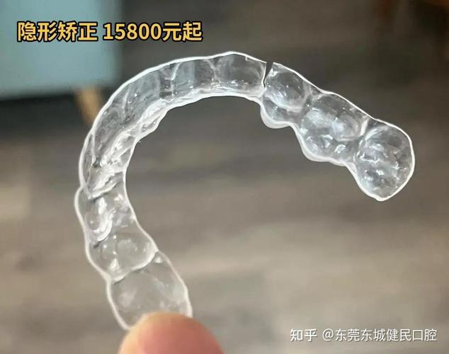 东莞矫正牙齿哪家好？求靠谱推荐！-图1