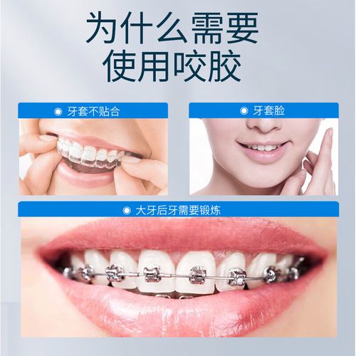 牙齿矫正 时代天使-图2