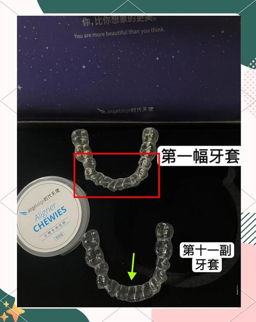 牙齿矫正 时代天使-图3