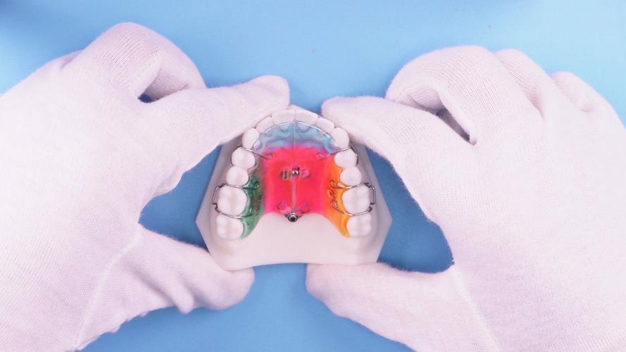 儿童牙齿活动矫正器效果如何？使用安全吗？-图2