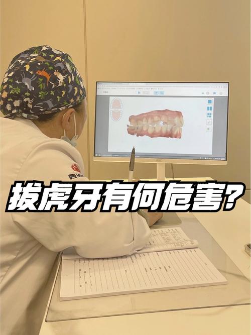 牙齿矫正拔虎牙?原因和后续影响有哪些?-图1 牙齿矫正拔虎牙?原因和后续影响有哪些?-图1
