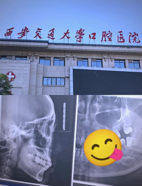 西安哪里矫正牙齿好-图3