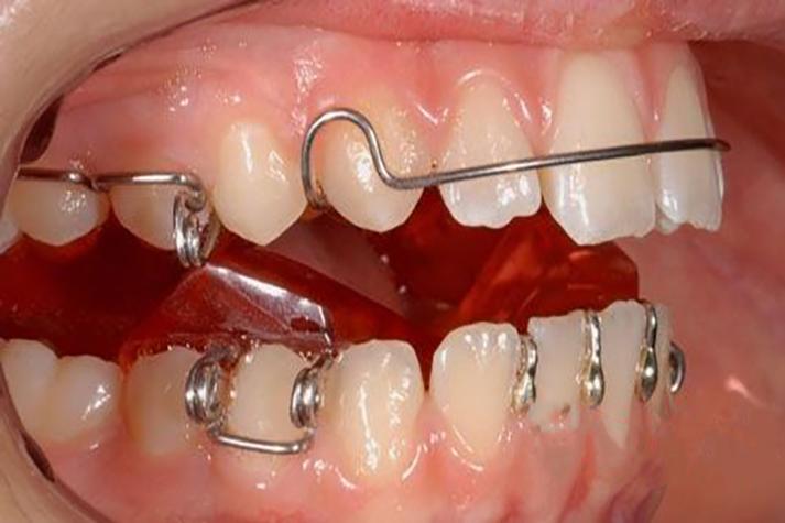 大同牙齿矫正哪里好？技术好、医生专业的靠谱机构怎么选？-图2