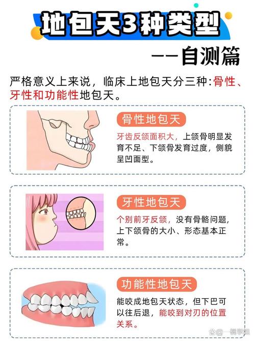 牙齿地包天如何矫正-图1 牙齿地包天如何矫正-图1