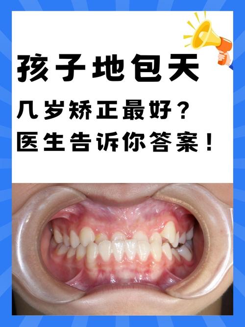 地包天矫正的最佳年龄是几岁？越早越好吗？-图1