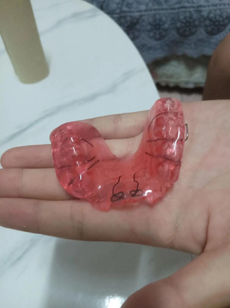 只矫正一颗牙齿可行吗？效果和风险如何？-图3