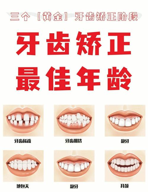 儿童牙齿矫正,几岁开始矫正效果最佳?-图2 儿童牙齿矫正,几岁开始矫正效果最佳?-图2