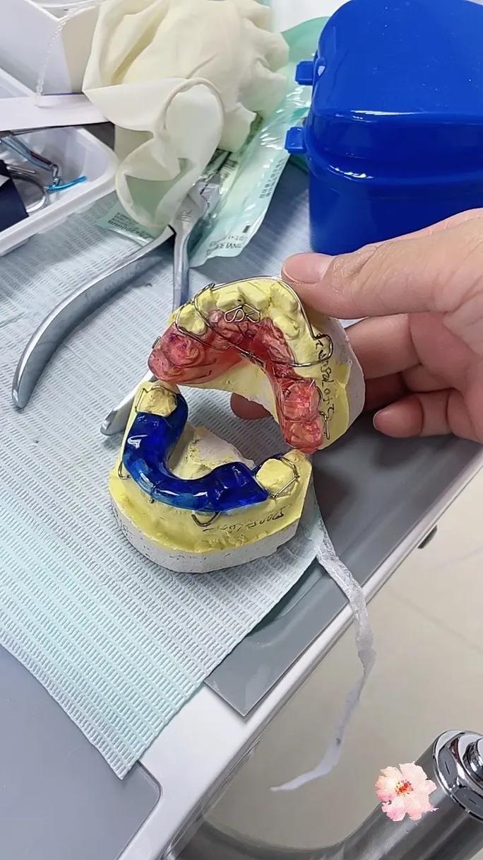 公立医院牙齿矫正效果如何？价格和流程靠谱吗？-图3