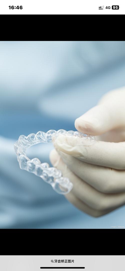 深圳隐形牙齿矫正怎么样？效果、价格、注意事项有哪些？-图3